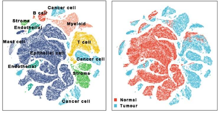 Image of single cell genomics cancer atlas